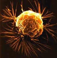 Big cell-generating cells cause
