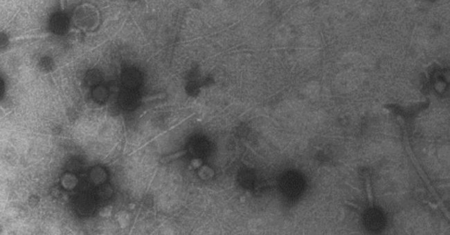 Billions of viruses are falling on our heads every day without anyone knowing