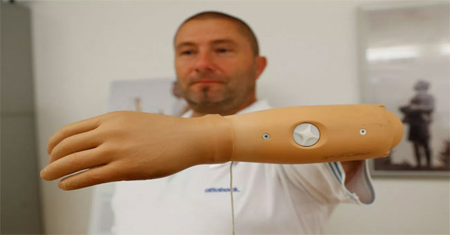 Biological arms controlled by brain signals