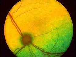 Biological eyes bring light to the blind
