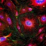Biological sensors help detect cancer early