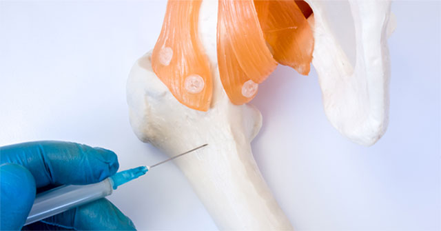 Biopsy: A test helps you diagnose cancer