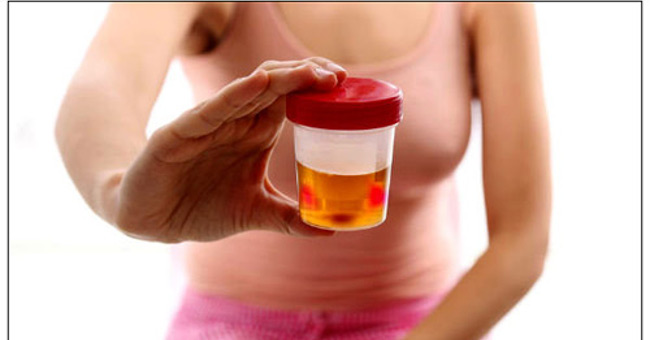 Bladder cancer is very scary, women must know these signs