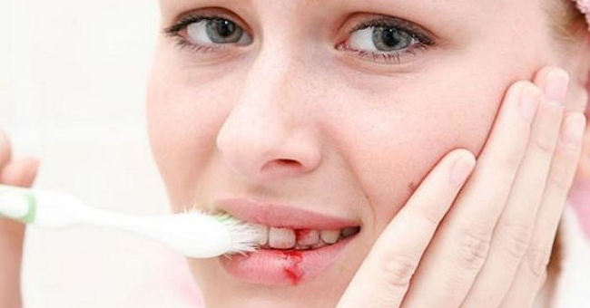 Bleeding from the teeth, little blood loss but not taken lightly