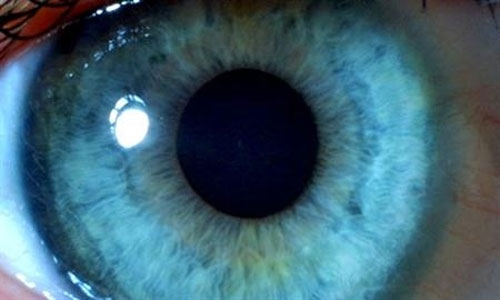Blindness with human embryonic stem cells