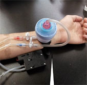 Blood filter made of nanofibers promises to replace dialysis machines