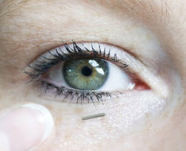 Blood glucose control with tiny sensor