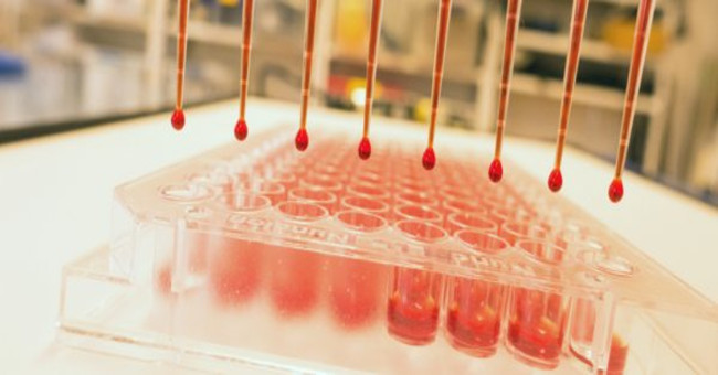 Blood test for early diagnosis of cancer with ... sound waves