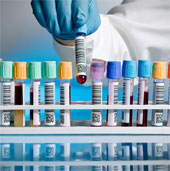 Blood test for oral cancer