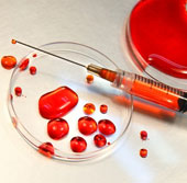 Blood test method helps detect cancer 5 years early