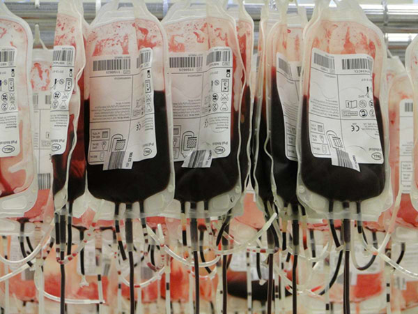 Blood type change after blood donation