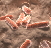 Bowel carotenoids are related to stroke