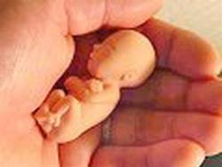 Boy 'pregnant' in stomach