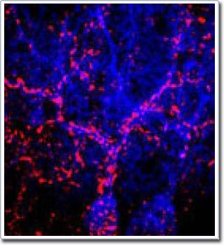 Brain damage and brain function can recover