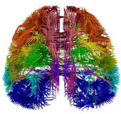 Brain diagram in the style of rainbow colors