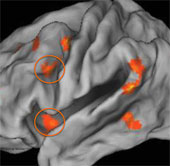 Brain function is affected if children live in poverty