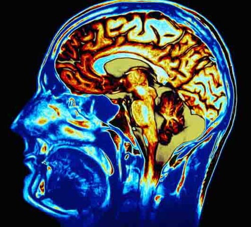 Brain size decisive political views!