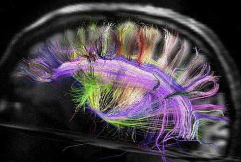 Brain structure changes during exams