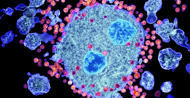 Breakthrough: Detecting antibodies can kill 99% of the HIV virus strain