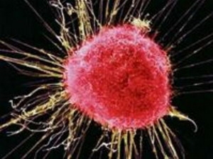 Breakthrough in immunotherapy for cancer cells