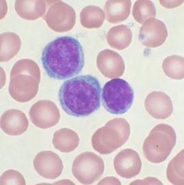Breakthrough in transplanting stem cells from dead people