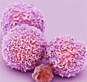 Breakthrough kill metastatic cancer cells