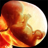Breakthroughs help women who don't have a uterus give birth