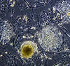 Breakthroughs in research on