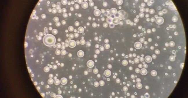Breast milk videos under a microscope attract millions of views