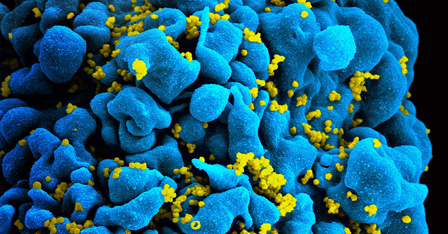 British men may be the first to be cured of HIV through new therapies