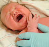 Caesarean babies are allergic