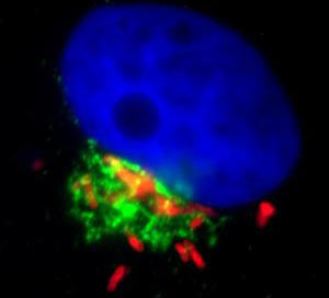 Campylobacter bacteria, the leading cause of food-borne illness in the United States, penetrates into cells like?