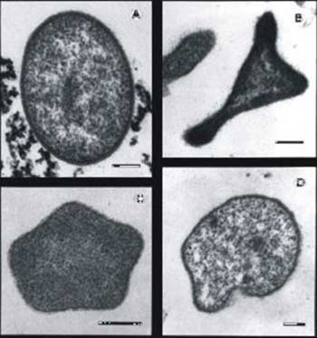 Can bacteria live at 121 degrees Celsius?
