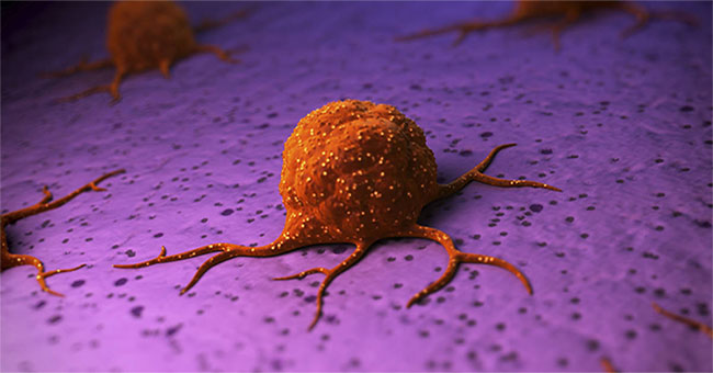 Can cancer free itself?