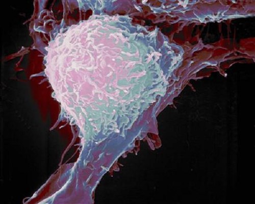 Can categorize prostate cancer