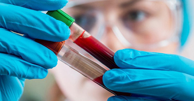Can detect 5 types of cancer at the same time with just one drop of blood