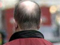 Can fix bald head!