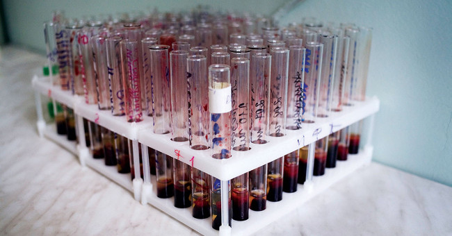 Can marrow transplant kill HIV cells?
