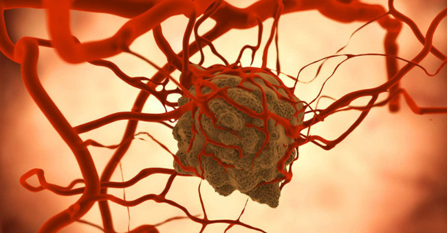 Cancer cells spread in the body in a more frightening way than you think