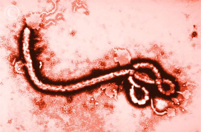 Cancer drugs can prevent Ebola virus