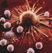 Cancer warning signs