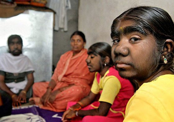 Cases of strange genetic changes in the world