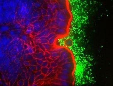 Cell sacrifices for the common good