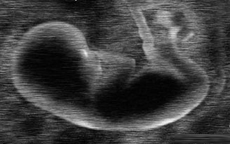 Check 3,500 genetic errors of children before birth