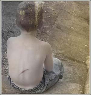 Child abuse is related to future health