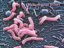 Children also have chronic stomach ulcers