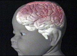 Children are more likely to die if they shake vigorously