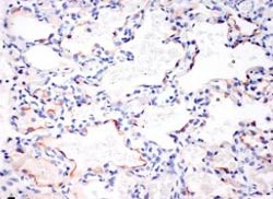 Children: Subjects susceptible to bird flu