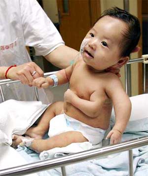 China: A baby has three hands