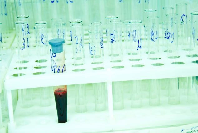 China detects HIV-blocking substances